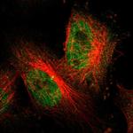 BCL6 Antibody in Immunocytochemistry (ICC/IF)