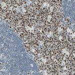 BCL6 Antibody in Immunohistochemistry (Paraffin) (IHC (P))