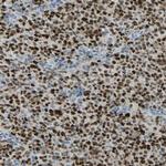 BCL6 Antibody in Immunohistochemistry (Paraffin) (IHC (P))