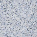 BCL6 Antibody in Immunohistochemistry (Paraffin) (IHC (P))