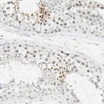 BCL6 Antibody in Immunohistochemistry (Paraffin) (IHC (P))