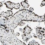 HP1 gamma Antibody in Immunohistochemistry (Paraffin) (IHC (P))