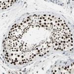 HP1 gamma Antibody in Immunohistochemistry (Paraffin) (IHC (P))