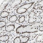 hnRNP D Antibody in Immunohistochemistry (Paraffin) (IHC (P))