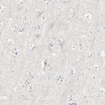 15-PGDH Antibody in Immunohistochemistry (Paraffin) (IHC (P))