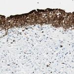 15-PGDH Antibody in Immunohistochemistry (Paraffin) (IHC (P))