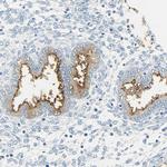 CD133 Antibody in Immunohistochemistry (Paraffin) (IHC (P))