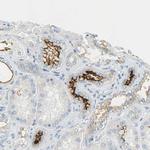 CD133 Antibody in Immunohistochemistry (Paraffin) (IHC (P))