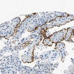 CD133 Antibody in Immunohistochemistry (Paraffin) (IHC (P))