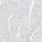 CD133 Antibody in Immunohistochemistry (Paraffin) (IHC (P))