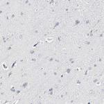 OATP8 Antibody in Immunohistochemistry (Paraffin) (IHC (P))