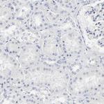 OATP8 Antibody in Immunohistochemistry (Paraffin) (IHC (P))