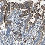 SLC2A5 Antibody in Immunohistochemistry (Paraffin) (IHC (P))