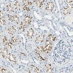 SLC2A5 Antibody in Immunohistochemistry (Paraffin) (IHC (P))