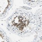 SLC2A5 Antibody in Immunohistochemistry (Paraffin) (IHC (P))