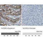 SLC2A5 Antibody