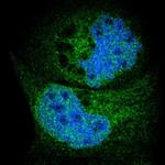 HRD1 Antibody in Immunocytochemistry (ICC/IF)