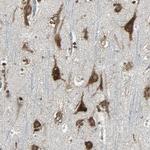 HRD1 Antibody in Immunohistochemistry (Paraffin) (IHC (P))