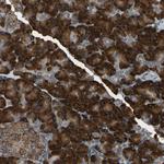 HRD1 Antibody in Immunohistochemistry (Paraffin) (IHC (P))