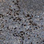 HRD1 Antibody in Immunohistochemistry (Paraffin) (IHC (P))