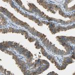 PRMT5 Antibody in Immunohistochemistry (Paraffin) (IHC (P))