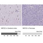 MEF2C Antibody