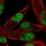 MEF2C Antibody in Immunocytochemistry (ICC/IF)