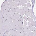 MEF2C Antibody in Immunohistochemistry (Paraffin) (IHC (P))