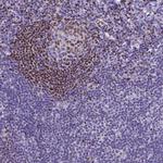 MEF2C Antibody in Immunohistochemistry (Paraffin) (IHC (P))