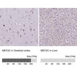 MEF2C Antibody