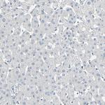 DLG7 Antibody in Immunohistochemistry (Paraffin) (IHC (P))