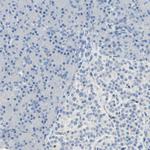 DLG7 Antibody in Immunohistochemistry (Paraffin) (IHC (P))