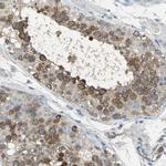 DLG7 Antibody in Immunohistochemistry (Paraffin) (IHC (P))