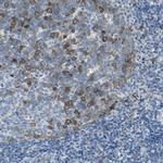 DLG7 Antibody in Immunohistochemistry (Paraffin) (IHC (P))