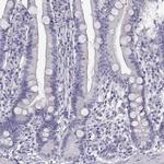 GCAP1 Antibody in Immunohistochemistry (Paraffin) (IHC (P))