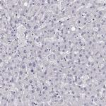 GCAP1 Antibody in Immunohistochemistry (Paraffin) (IHC (P))