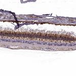 GCAP1 Antibody in Immunohistochemistry (Paraffin) (IHC (P))