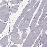 GCAP1 Antibody in Immunohistochemistry (Paraffin) (IHC (P))