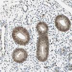 MSX2 Antibody in Immunohistochemistry (Paraffin) (IHC (P))