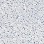 MSX2 Antibody in Immunohistochemistry (Paraffin) (IHC (P))