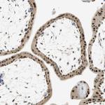 MSX2 Antibody in Immunohistochemistry (Paraffin) (IHC (P))