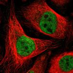 DLX5 Antibody in Immunocytochemistry (ICC/IF)