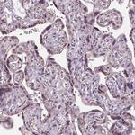 DLX5 Antibody in Immunohistochemistry (Paraffin) (IHC (P))