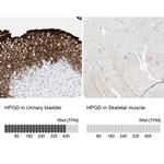 15-PGDH Antibody