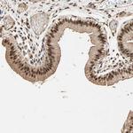 Kaiso Antibody in Immunohistochemistry (Paraffin) (IHC (P))