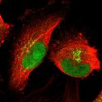 PRDM2 Antibody in Immunocytochemistry (ICC/IF)