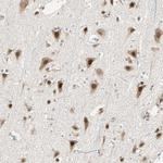 PRDM2 Antibody in Immunohistochemistry (Paraffin) (IHC (P))