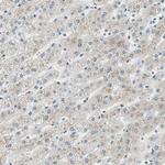 PRDM2 Antibody in Immunohistochemistry (Paraffin) (IHC (P))