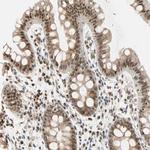 PRDM2 Antibody in Immunohistochemistry (Paraffin) (IHC (P))