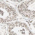 PRDM2 Antibody in Immunohistochemistry (Paraffin) (IHC (P))